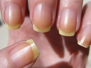 Ногти после шеллака становятся желтые